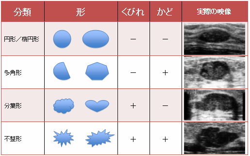 （2）腫瘍の形状について（乳房超音波ガイドラインより）